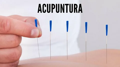 Top Acupuncture Clinics in Sydney: Where to Find Expert Care